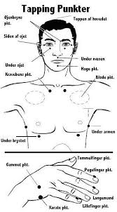 Her vises de punkter man arbejder på